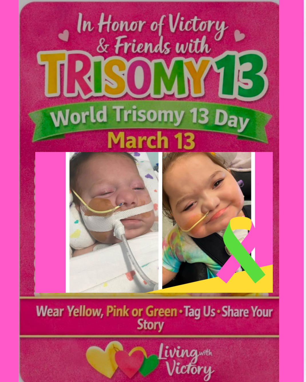 World Trisomy 13 Day: Trisomy 13 Facts, Awareness, and Victory’s Story